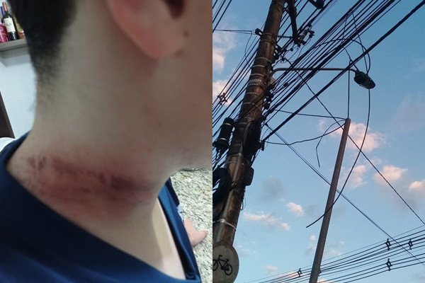 Adolescente fica ferido após acidente com fiação solta em Blumenau