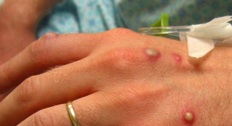 Foto: Divulgação/ Reprodução