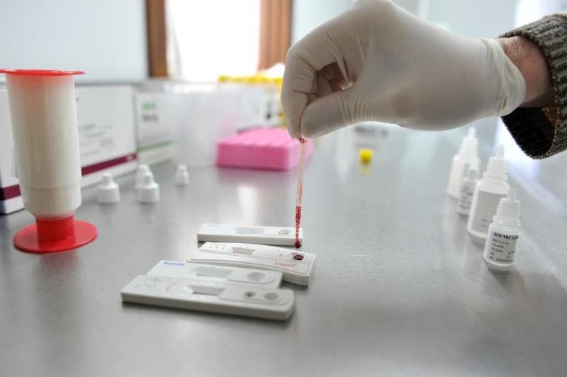 Blumenau é uma das primeiras cidades de SC a eliminar a transmissão vertical do HIV/AIDS