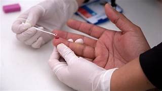 HIV: Brasil cumpre meta de pessoas em tratamento antirretroviral