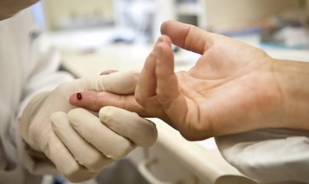 Casos de sífilis e de HIV/aids aumentam entre homens jovens no Brasil