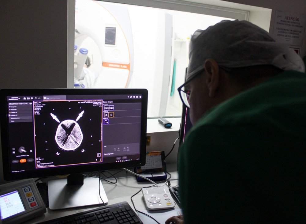 Hospital Santo Antônio faz primeira biópsia cerebral guiada por sistema tridimensional pelo SUS