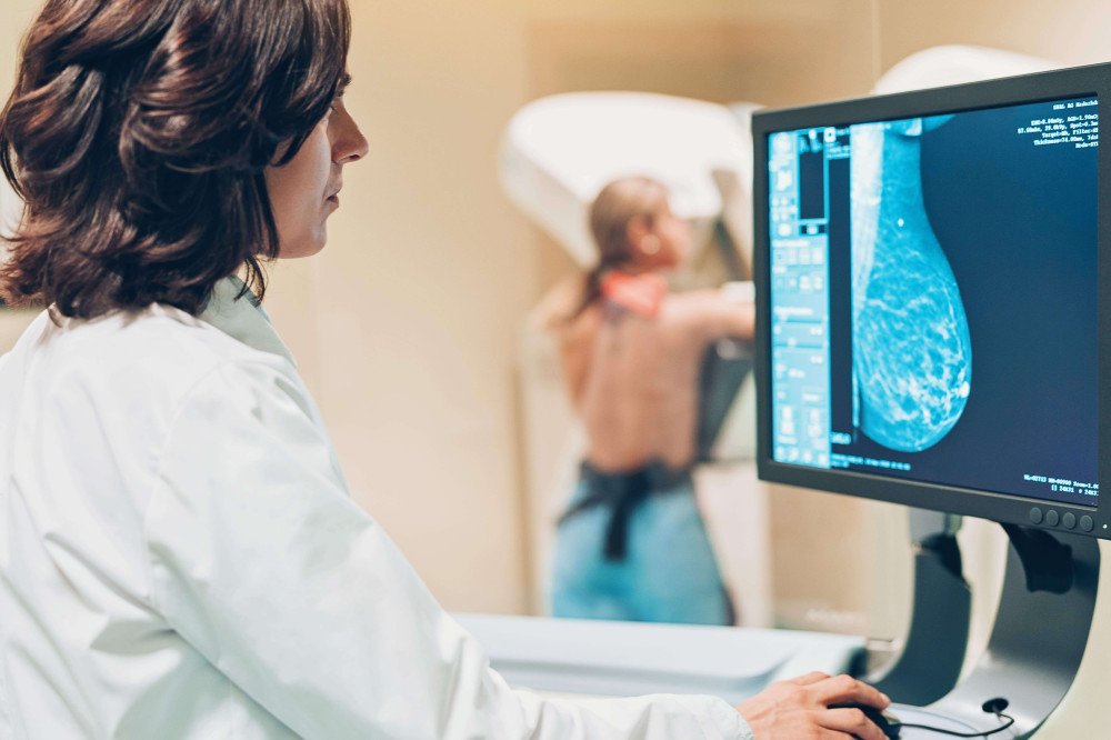 Fila de espera por mamografia entre mulheres de 50 e 69 anos é zerada em Indaial