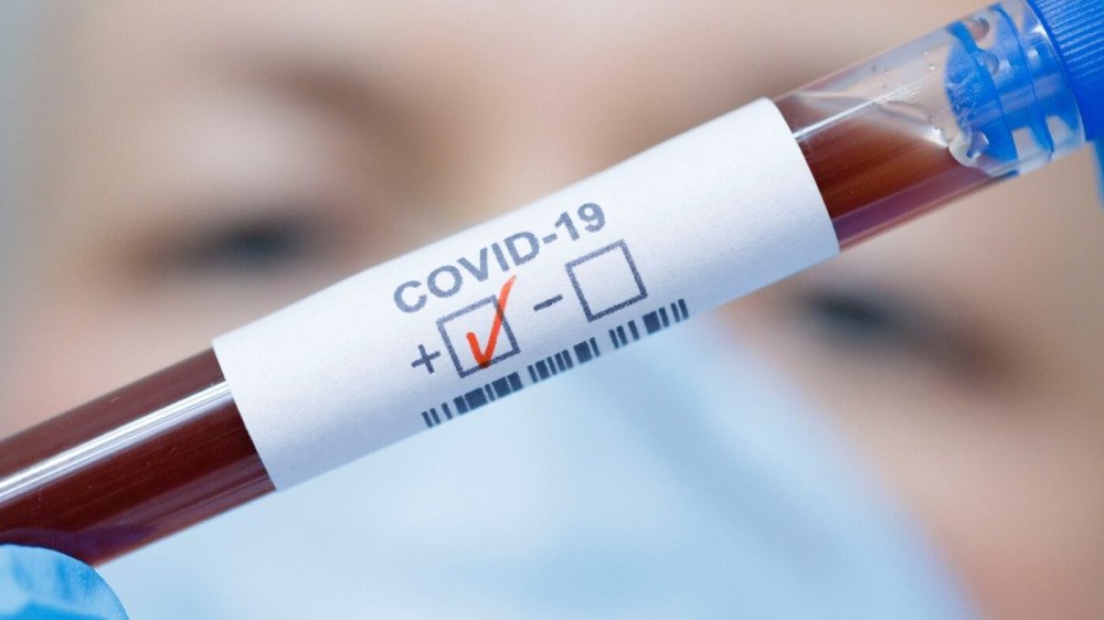 Blumenau registra 35 novos casos de Covid-19