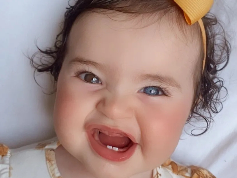 Família de Blumenau pede ajuda para bebê com perda de audição profunda nos dois ouvidos; saiba como ajudar