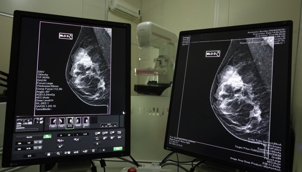 Mutirão de mamografias acontece neste mês de março em Santa Catarina