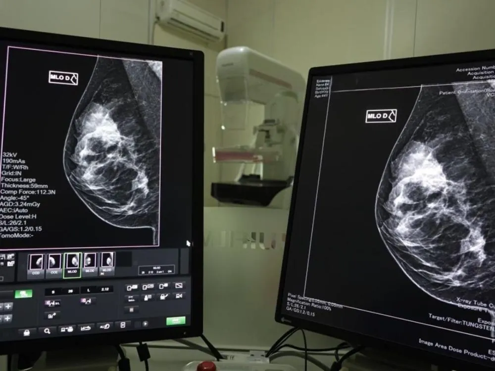 Câmara aprova lei que garante mamografia anual pelo SUS para mulheres a partir dos 40 anos