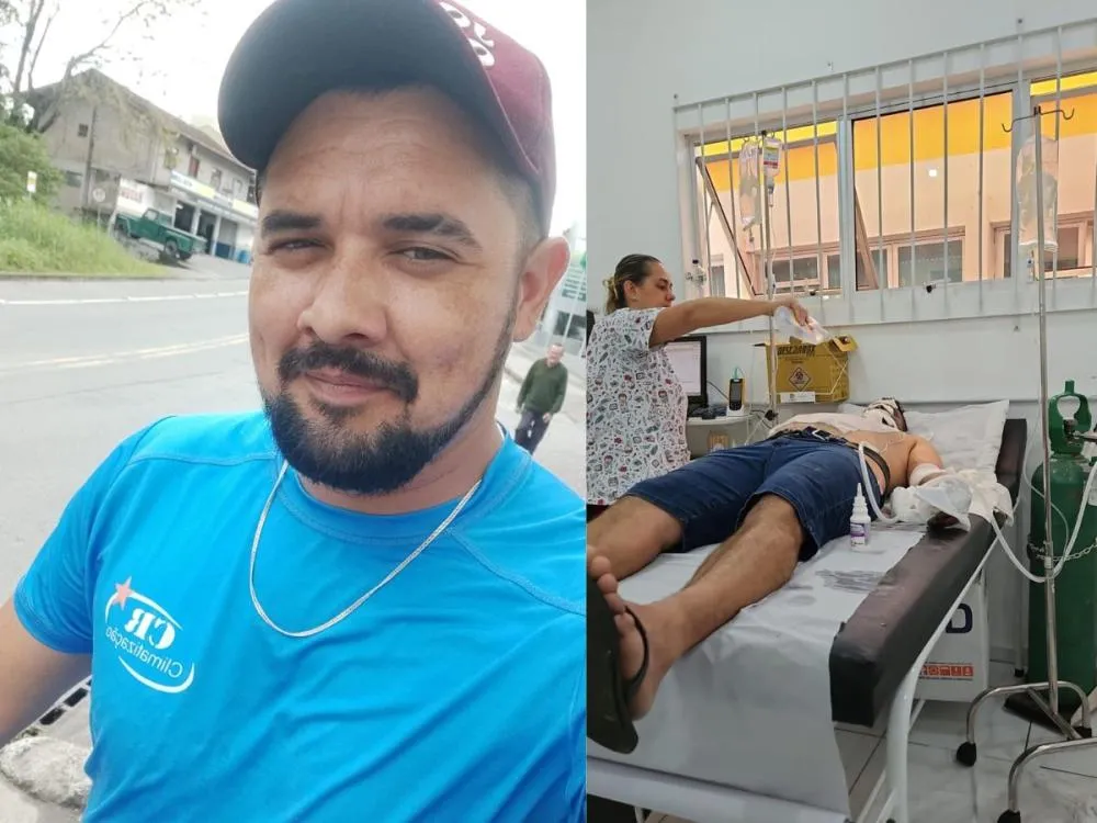 Após explosão em serviço, família de Blumenau faz rifa para ajudar trabalhador internado em estado grave