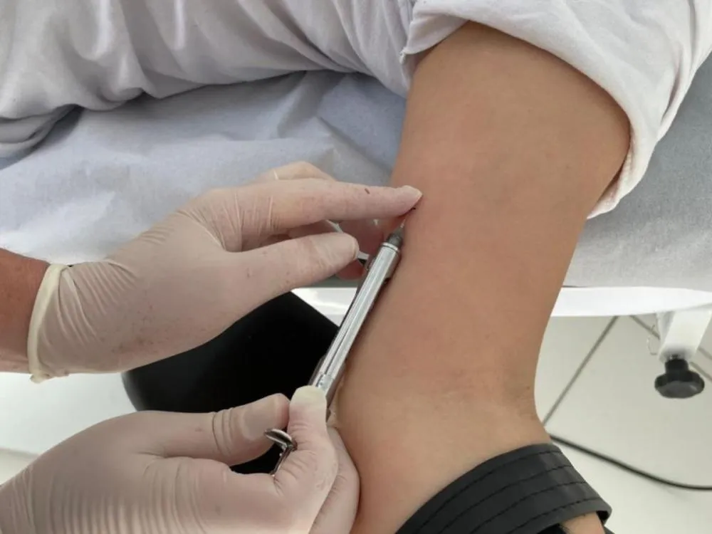 Blumenau passa a oferecer Implanon na rede pública a partir desta segunda-feira